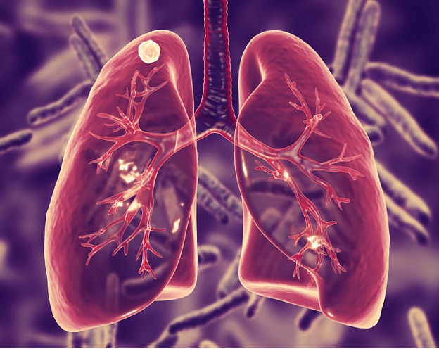 24 марта  Всемирный день борьбы с туберкулезом